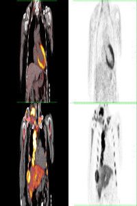 Molecular Oncologic Imaging-Cover